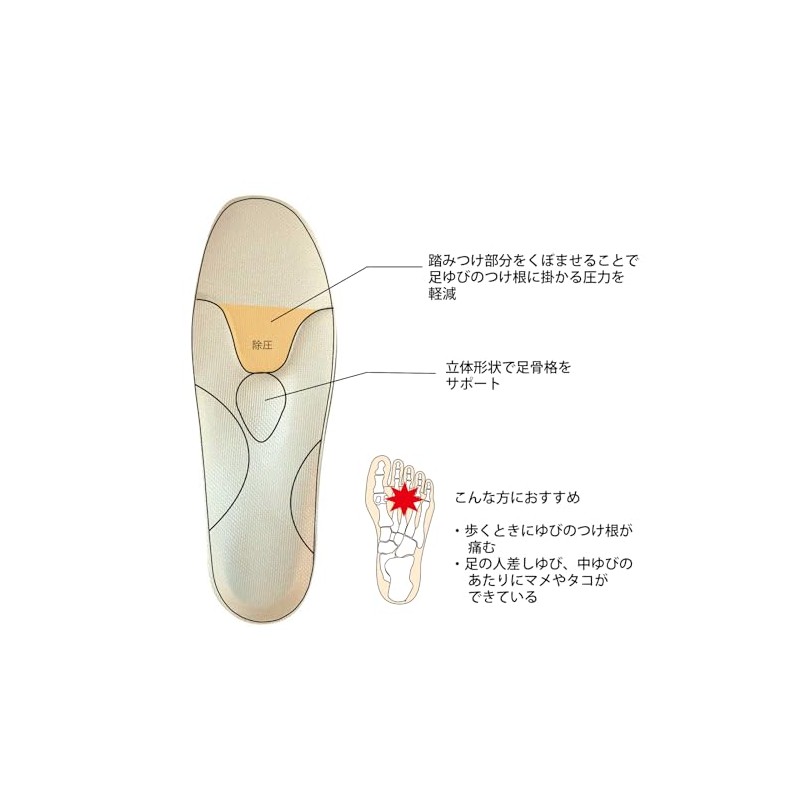 Shoesfit.com(シューズフィットドットコム) 村井 インソールプロ(靴用中敷き) 中足骨頭部痛対策 レディス・女性用 S(22~22.5cm)