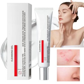 15% Acid Acne Treatment Gel,Anti Acne Face Cream,Face Acne Treatment,Acid 15% Facial Serum Cream,Spot Treatment,Gentle Acne Cream,Spot Serum Cream for Face,Pimple Treatment Gel Cream,Face Gel for Acne
