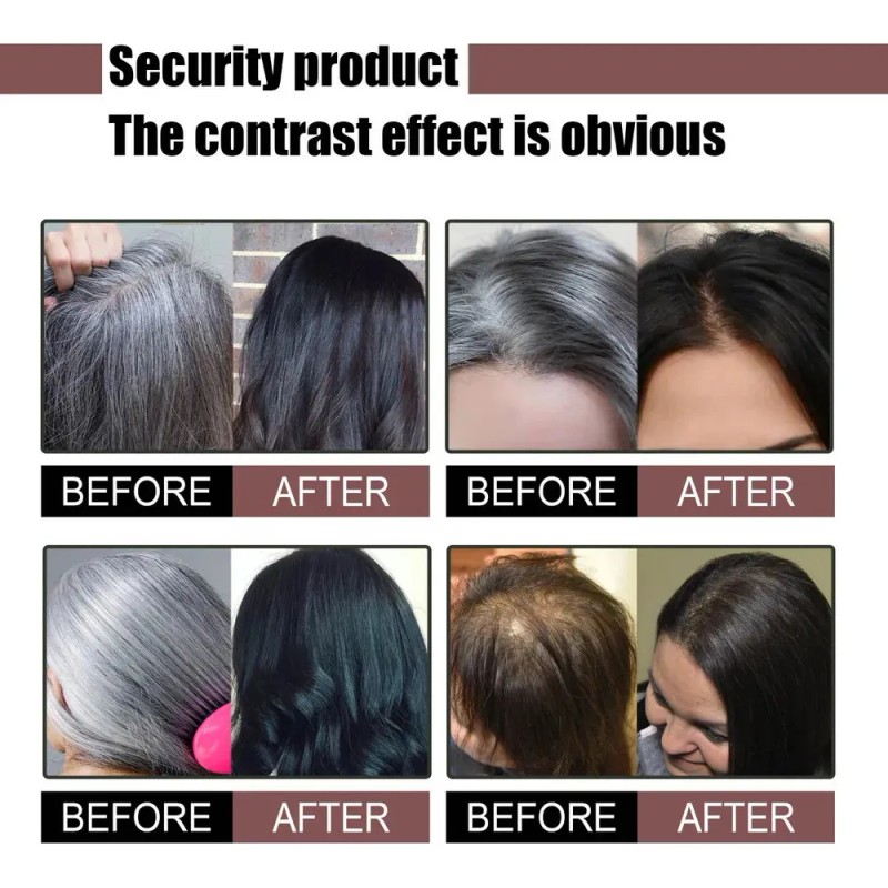 3 Champú Negro Para Cabello Grueso, Champú Anticanceroso, Ja