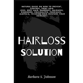 Hairloss Solution: Natural Guide on how to prevent, control, treat hair loss, grey hair, dandruff, baldness, ringworm, folliculitis, psoriasis, ... (restore your hairline) (Adangme Edition)