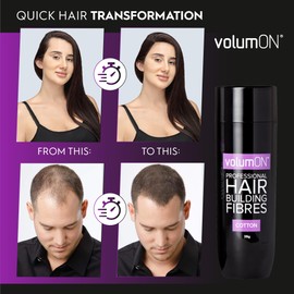 Volumon Professional Hair Building Fibres, Hair Loss Concealer, Cotton, 28 g, Up to 30 Get Use, From 8 Hair Shades Colours Choose (White)