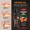 Aceite De Batana For El Crecimiento Del Cabello Con