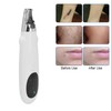 Rechargeable Red Light Laser Picosecond Pen Handheld Spot Mole Acne