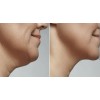 Crema Para Reducir Papada Tonificar Cuello Adelgaza Reafirma Fresh