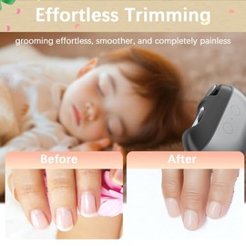 Electric Nail Clipper with Polishing, RIMOL 3-in-1 Automatic Nail Trimmer with LED Light & Nail Scraps Storage, Painless Grooming for Adults, Women, M
