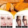 Turmeric Serum for Dark Spots, Reduces Hyperpigmentation, Age Spots, Sun