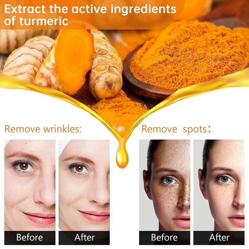 Turmeric Serum for Dark Spots, Reduces Hyperpigmentation, Age Spots, Sun