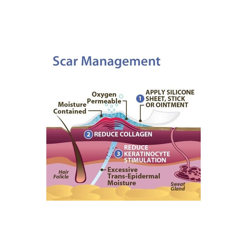 Scar Aid, lámina de silicón grado médico para reducir cicatrices