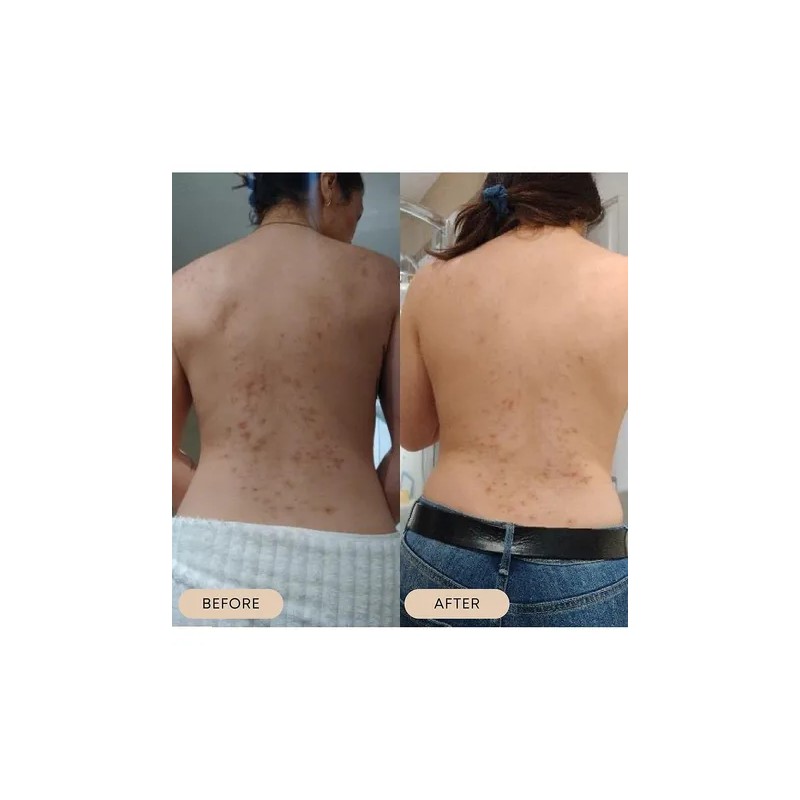 Bushbalm Rutina De 2 Pasos Para Hiperpigmentación Y Manchas