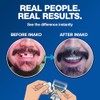 Imako Cosmetic Teeth Extras (Tooth Tinted Plastic)- Natural Color by