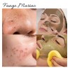 Mascarilla Fango Marino Estrías Flacidez Piel Revitalizada