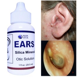EAR DROPS SILICA ALKALINE SOLUTION Tinnitus Fungi Deafness Infection By ALKAVITA
