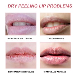 Pink Lip Nourishment & Moisture - Balm & Oil Duo for Soft and Pliable Lips - Makeup Base - Soothing & Hydrating - Sweet Lip Balms