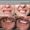 Dentures Set, False Artificial Temporary Teeth Braces Smile Veneers Cosmetic