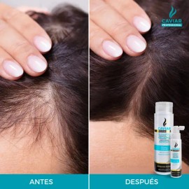 Tratamiento anticaída, Crecimiento y Fortalecimiento dúo Shampoo y loción con extracto de Caviar Biomimético