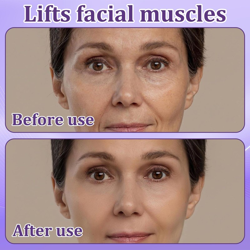 Pack of 240 Face Lifting Tape Wrinkle Plasters Face Lifting