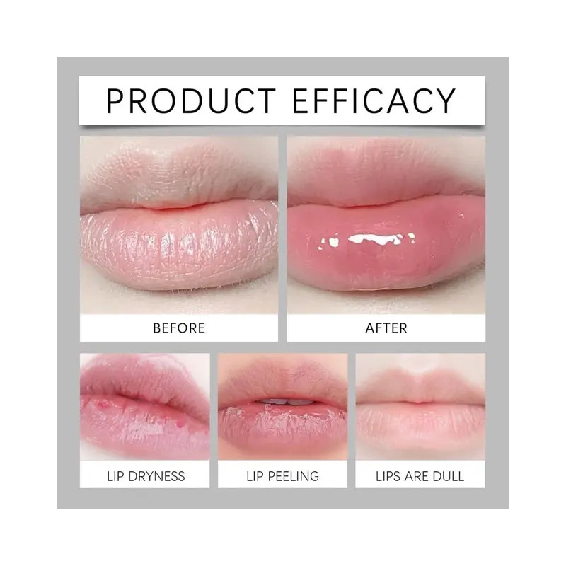 Crema De Labios Belani Fordyce, 2 Unidades