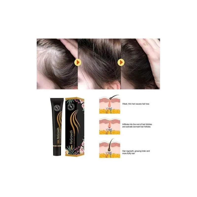 Rollo De Suero Orgánico Para El Crecimiento Del Cabello Recr