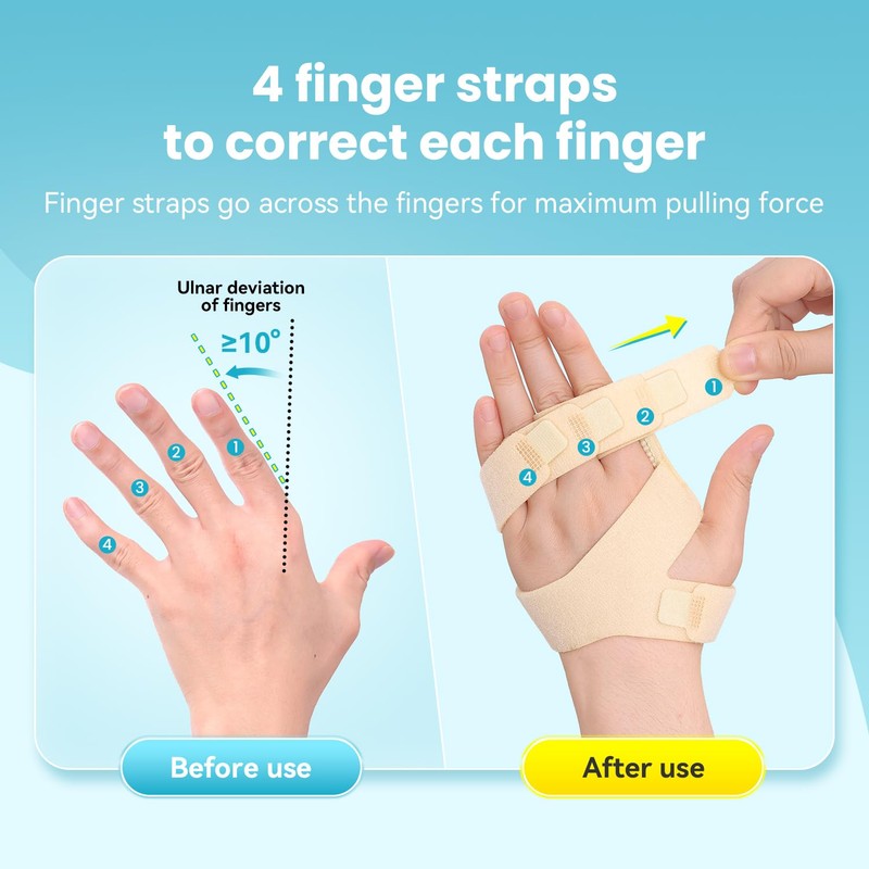 DrFinger Finger Ulnar Deviation Splint Brace, Finger Joint Deviation Orthopedic