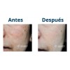 Accuderm Suero Despigmentante Regulador 30ml Unifica El Tono