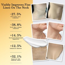 AH-8 Firming Neck Cream, AH-8 Hals Straffende Cremes Roller mit Hexapeptide, Firming Neck Cream zur Reduzierung von Falten,Halslinien & Schlaffer Haut (C, one size)