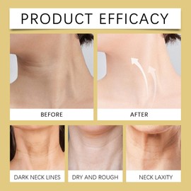 AH8 Neck Firming Cream, ah-8 Firming Neck Cream, Neck Firming Creams Contain Hexapeptide, With Double Roller Massage, Reduce Wrinkles Fine Lines And Double Chin, Firm And Lift Sagging Skin