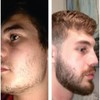 Bálsamo para crecimiento de barba al 7% con Bergamota y