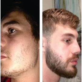 Bálsamo para crecimiento de barba al 7% con Bergamota y vitamina A y E