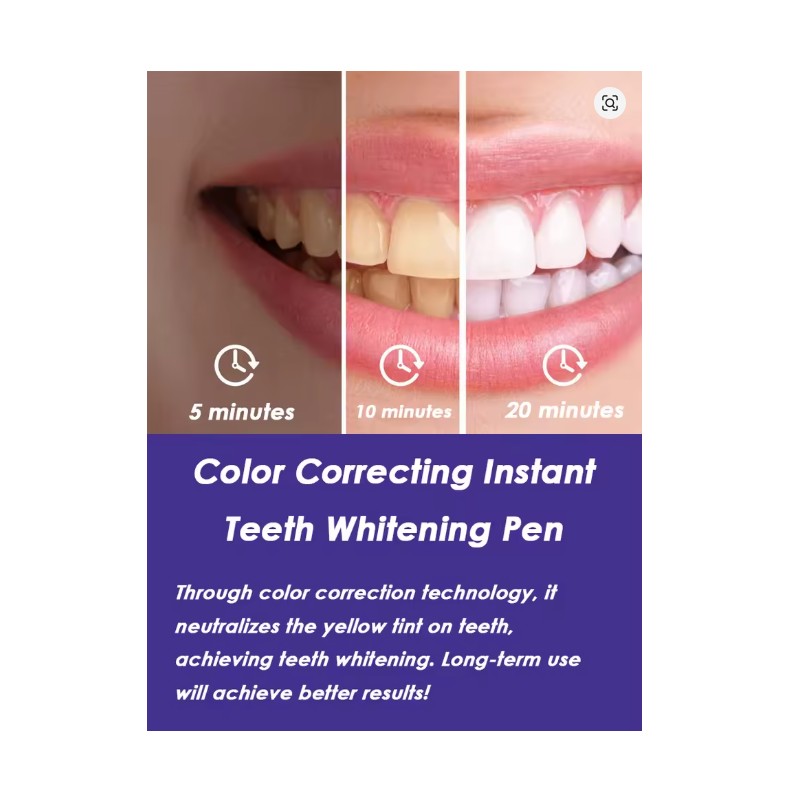 DIPSEVEN Teeth Whitening Pen - On-the-Go Whitening Gel Pen