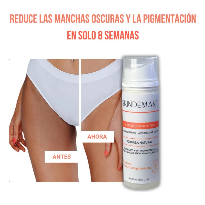Crema Despigmentante Para Manchas, Melasma, Acné Y Paño Skid