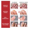 Fungicida Para Uñas Eliminar Hongos En Uñas De Manos Y