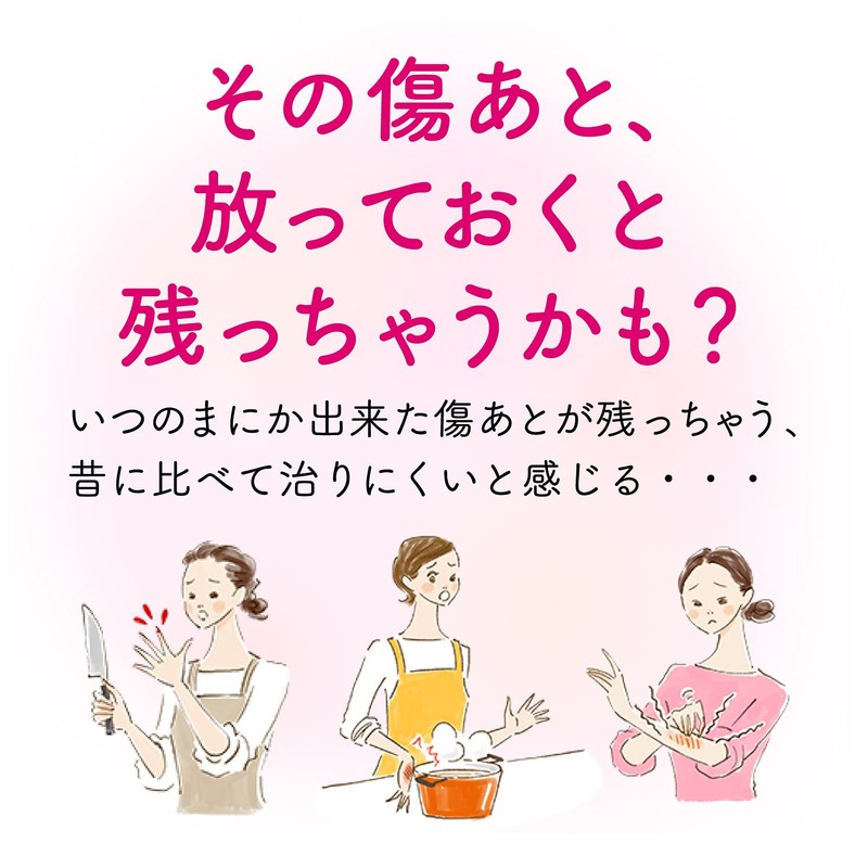 【第2類医薬品】アットノンEX ジェル 15g