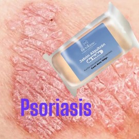 Skin Moisturizer 4 Piezas Psoriasis Facial Time