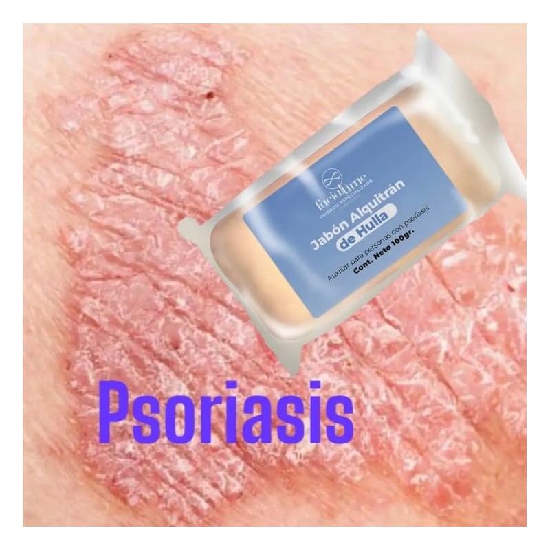 Skin Moisturizer 4 Piezas Psoriasis Facial Time