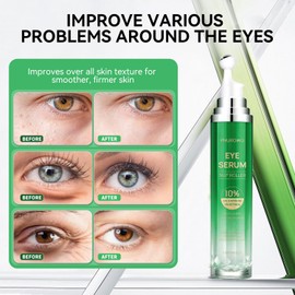 Eye Serum with 5% Caffeine & 5% Retinol for Dark Circles, Puffiness Puffy Bags & Wrinkles Fine Lines - Under Eye Roller Cream Anti Aging Treatment with 360° Massage Ball for Men and Women