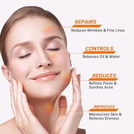 Suero de niacinamida 10% + 1% de zinc, suero de niacinamida antienvejecimiento para cara, 1 suero facial hidratante para todo tipo de piel, cuidado de