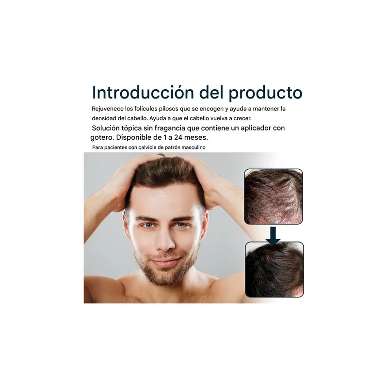 Pack de 3 Esencias Anticaída MOPOYAT para Hombre con Extra
