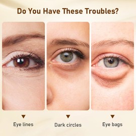 Yayabb Niacinamide Eye Cream for Dark Circles & Puffiness – Hydrating Under Eye Treatment for Fine Lines & Wrinkles – Firming & Anti-Aging – Sensitive Skin Safe, Fragrance-Free