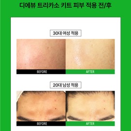 Dievu Dieevu Tricasso Kit [Ampoule Gel Casal Cream] Moisture glow cooling intensive moisture care / 디에뷰 트리카소키트 [앰플 젤 카살크림]수분 물광 쿨링 집중수분케어