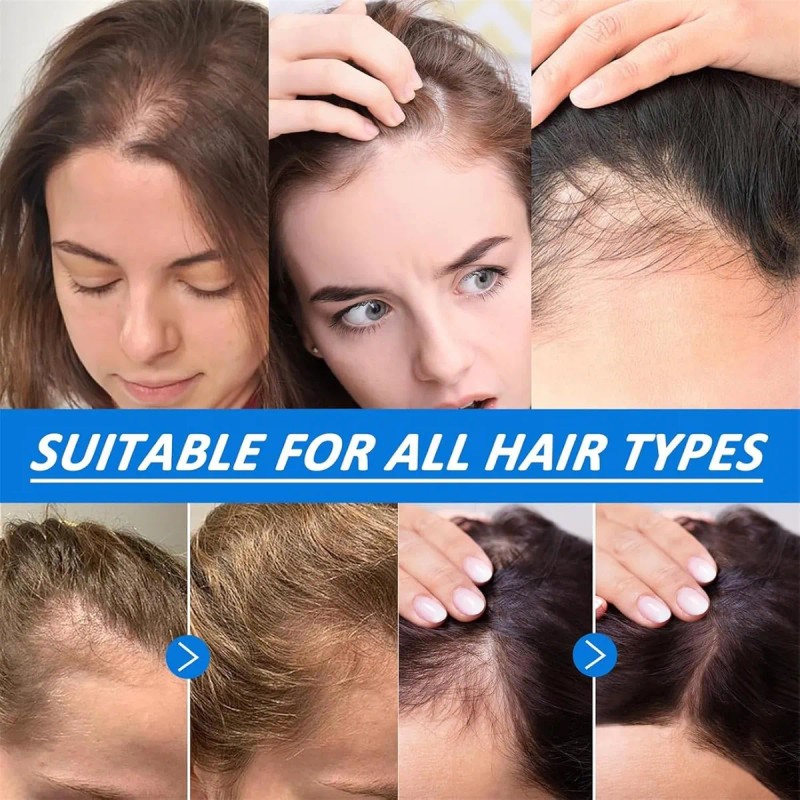 Suero Para El Crecimiento Del Cabello (3 Unidades)