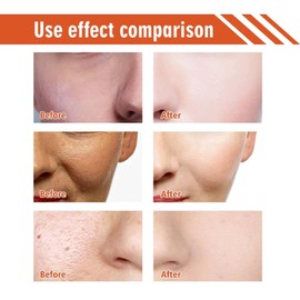 Rice Cream for Face,Anti Aging Face Cream,Hydrating Face Moisturiser,Rosacea Crea-m for Face,Moisturiser Fac-e Women,Skin Tightening Cre-am for Fa-ce,Cr-eam of Rice,Ri-ce Toner,Day Cr-eam,Night Cre-am