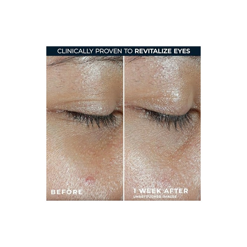 RoC Multi Correxion Revive + Glow Vitamin C Eye Balm