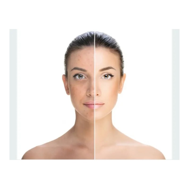 Concentrado Vitamina C Elimina Manchas Paño Ojeras 100% Natu Normal