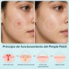 360 Parches Para Acné, Pimple Patch