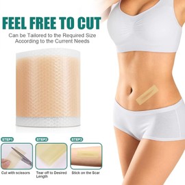 Cinta de silicona para cicatrices 1.5m,Reduce Marcas Antiguas y Nuevas por Quemaduras, Rozaduras o Heridas,Uso Diario Reutilizable para todo tipo de cicatrices (1.5M)