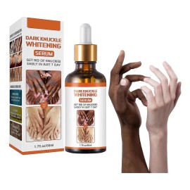 Serum Blanquador Nudillos Rodillas Codos Sadoer 50ml