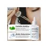 Set Cuidado Facial Weud Con Serum Crema Acido Hidratante