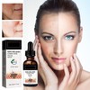 Melanin Correcting Facial Serum, Dark Spot Corrector Daily Face Serum,