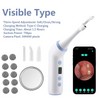 Electric Tonsil Stone Remover for Oral Care – Rechargeable Suction