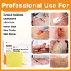 Carbou Medical Xeroform Petrolatum Dressing 2"x2", 25 Individual Pack, Non-Adherent